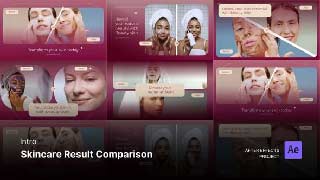 Intro Opening-Skincare Result Comparison After Effects Project Files